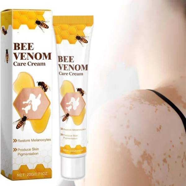 vitigo bee venom treatment cream | skin repair & hydration
