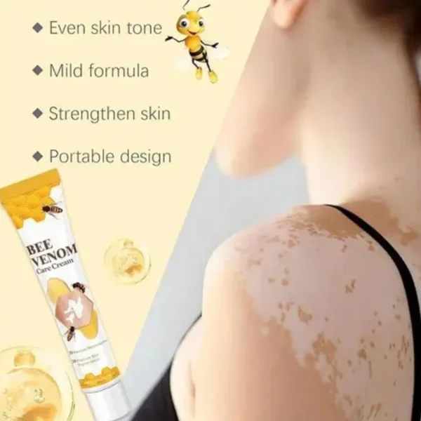 vitigo bee venom treatment cream | skin repair & hydration