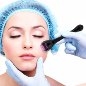 derma roller titanium micro needle drs 540 pins derma roller stainless steel for facial skin care hair loss treatment tool 6 1727331614.webp